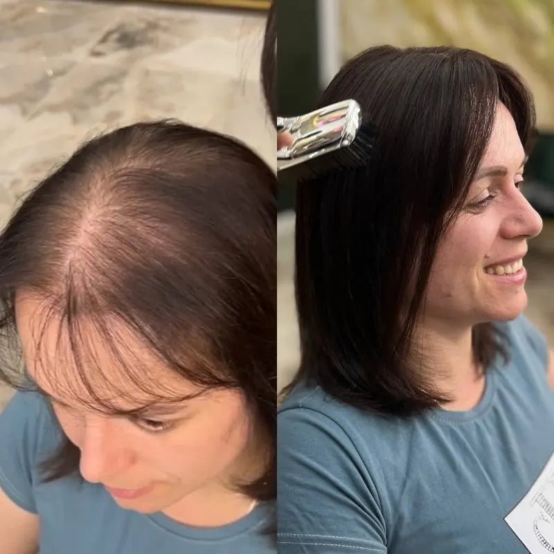 Straight Hair Topper for Crown Thinning  ̈C Natural Coverage at the Crown