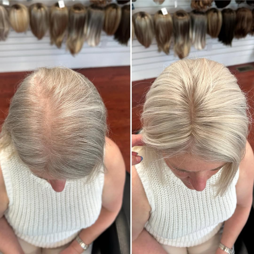 Straight Hair Topper for Crown Thinning  ̈C Natural Coverage at the Crown