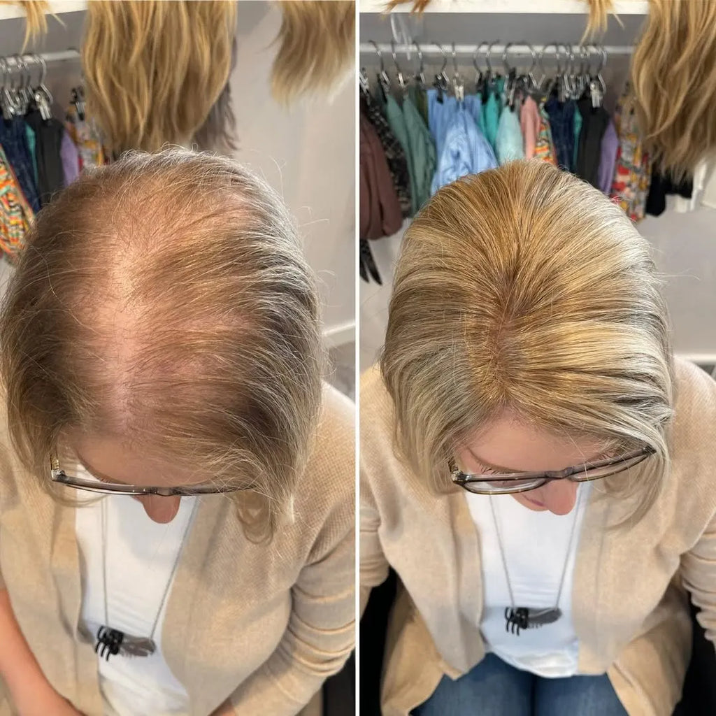 Straight Hair Topper for Crown Thinning  ̈C Natural Coverage at the Crown