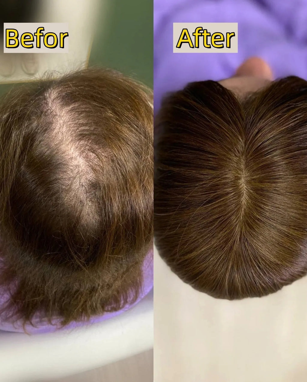 Straight Hair Topper for Crown Thinning  ̈C Natural Coverage at the Crown