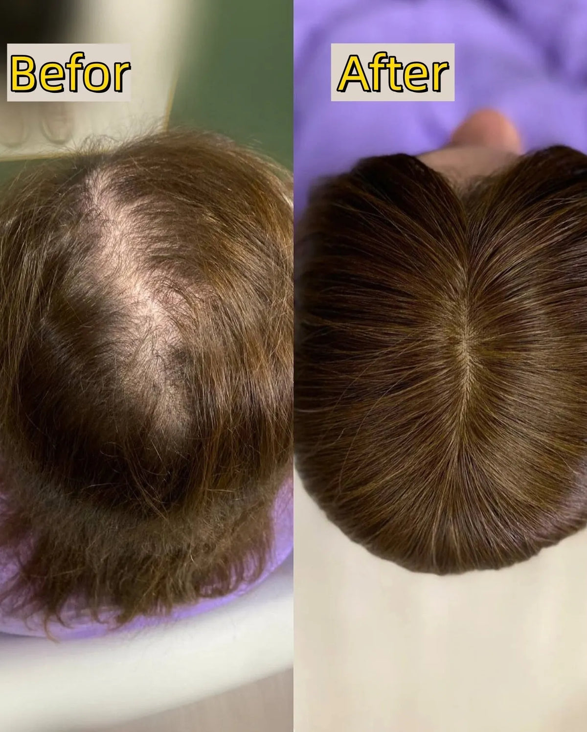 Straight Hair Topper for Crown Thinning  ̈C Natural Coverage at the Crown